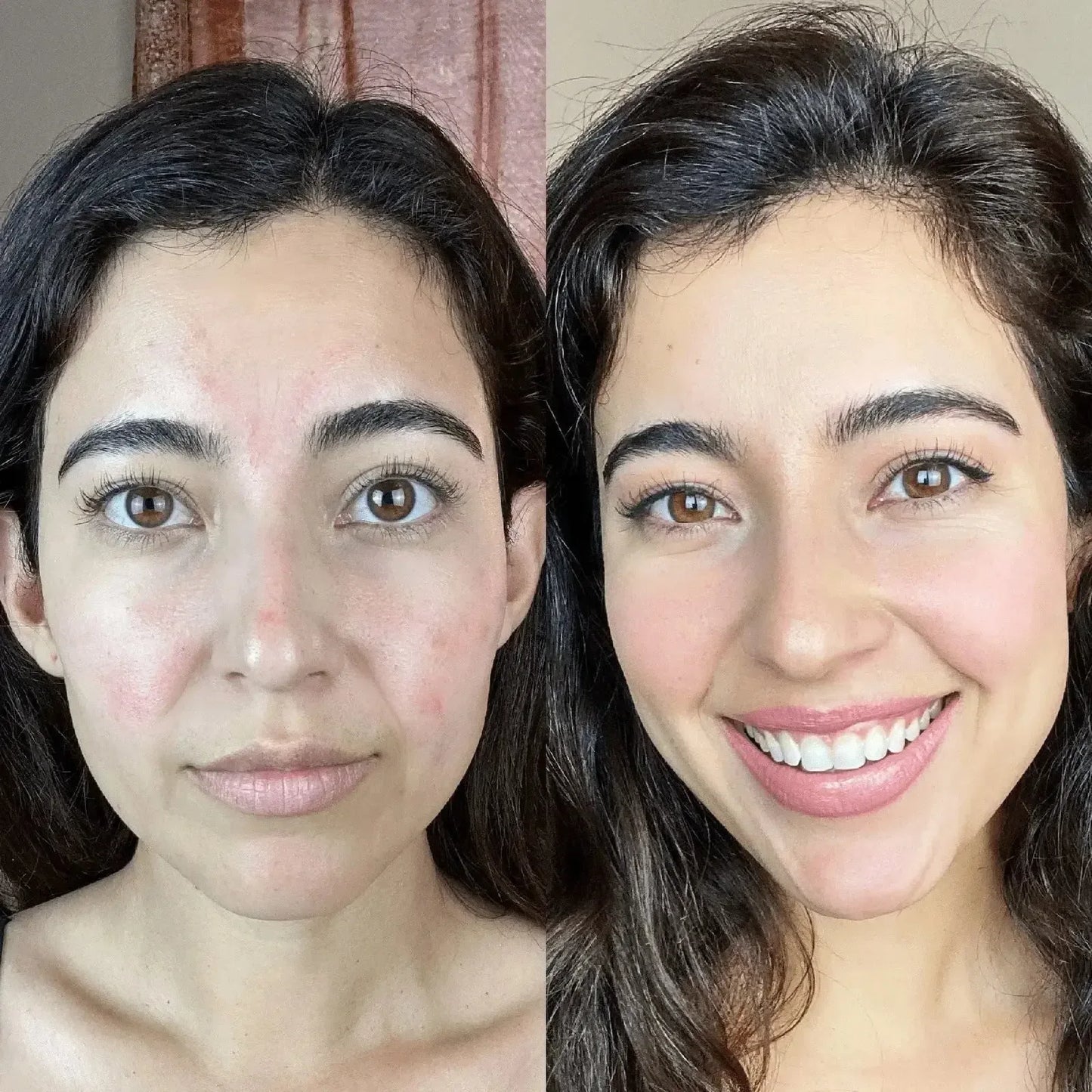 GlowLift Gesichtsstraffer