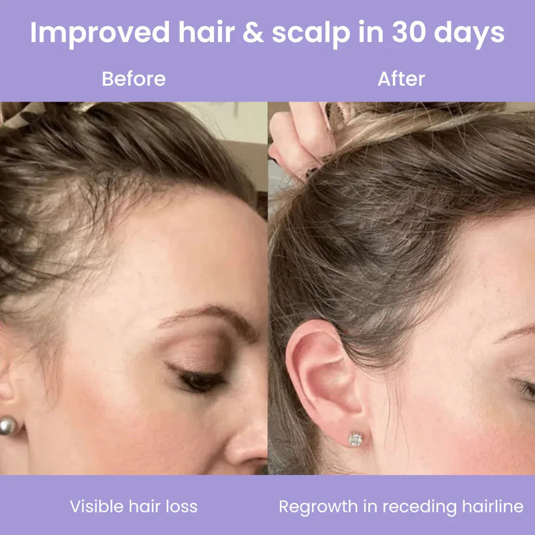 Clyinc Filtered Showerhead