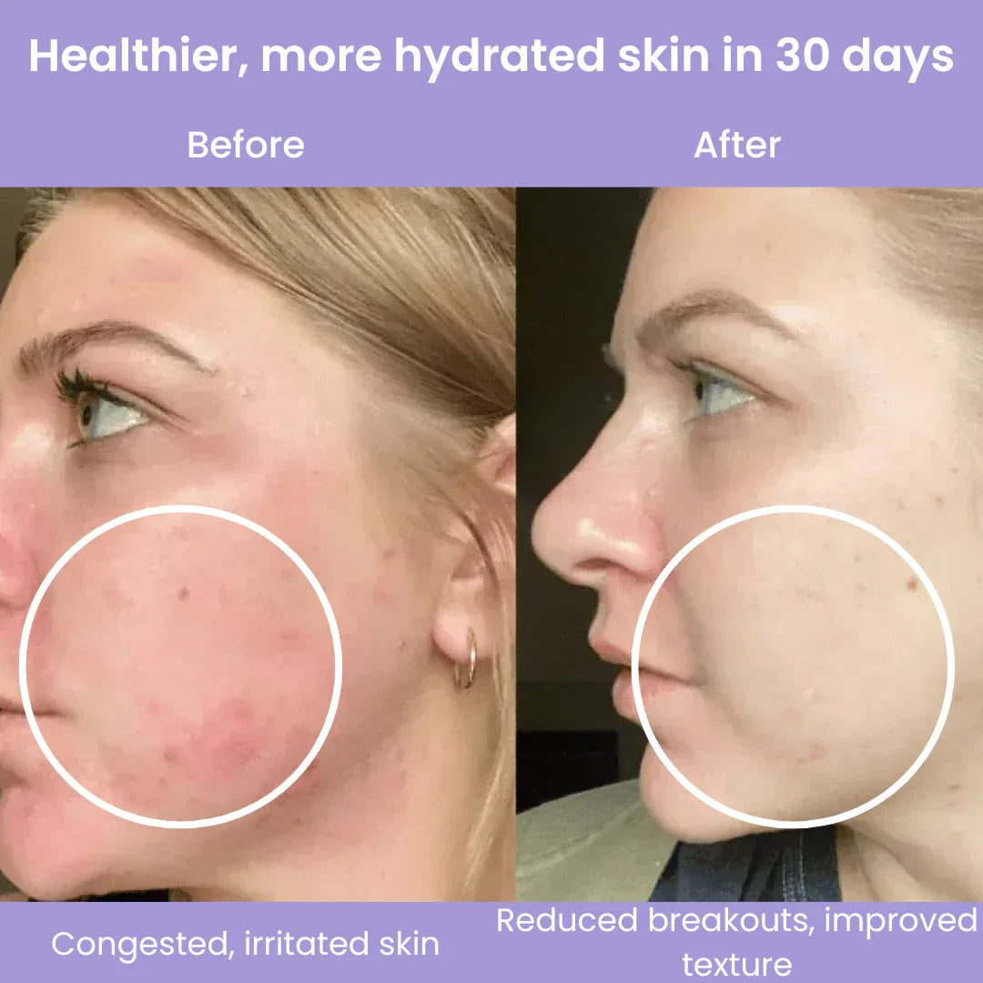 Clyinc Filtered Showerhead