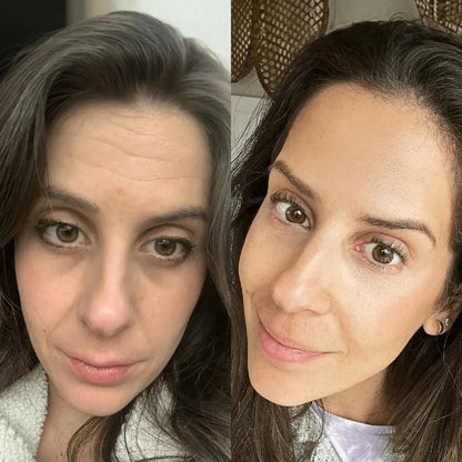 GlowLift Gesichtsstraffer