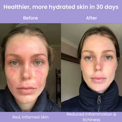 Clyinc Filtered Showerhead