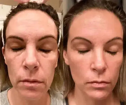 GlowLift Gesichtsstraffer