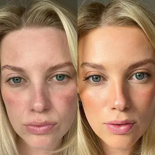 GlowLift Gesichtsstraffer