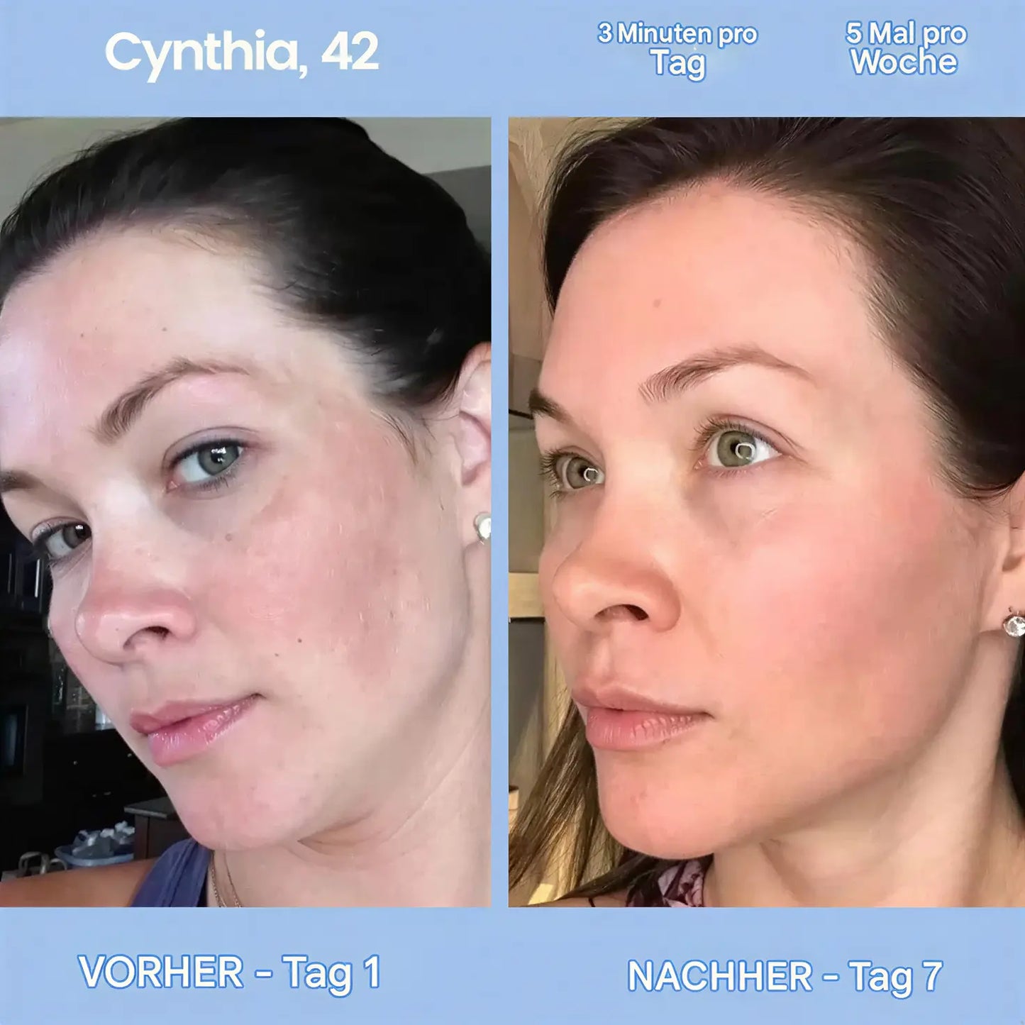 GlowLift Gesichtsstraffer