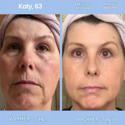 GlowLift Gesichtsstraffer